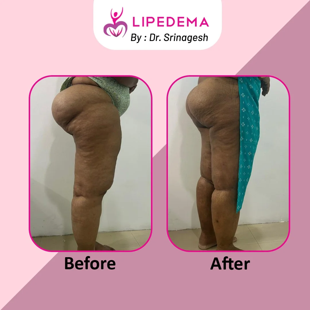 WhatsApp Image 2023-12-06 at 3.32.23 PM (1)