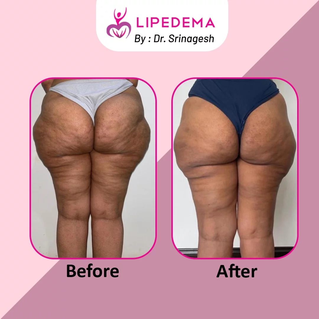 WhatsApp Image 2023-12-06 at 3.32.23 PM (4)