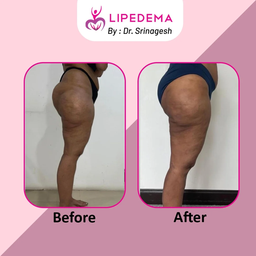 WhatsApp Image 2023-12-06 at 3.32.23 PM (6)