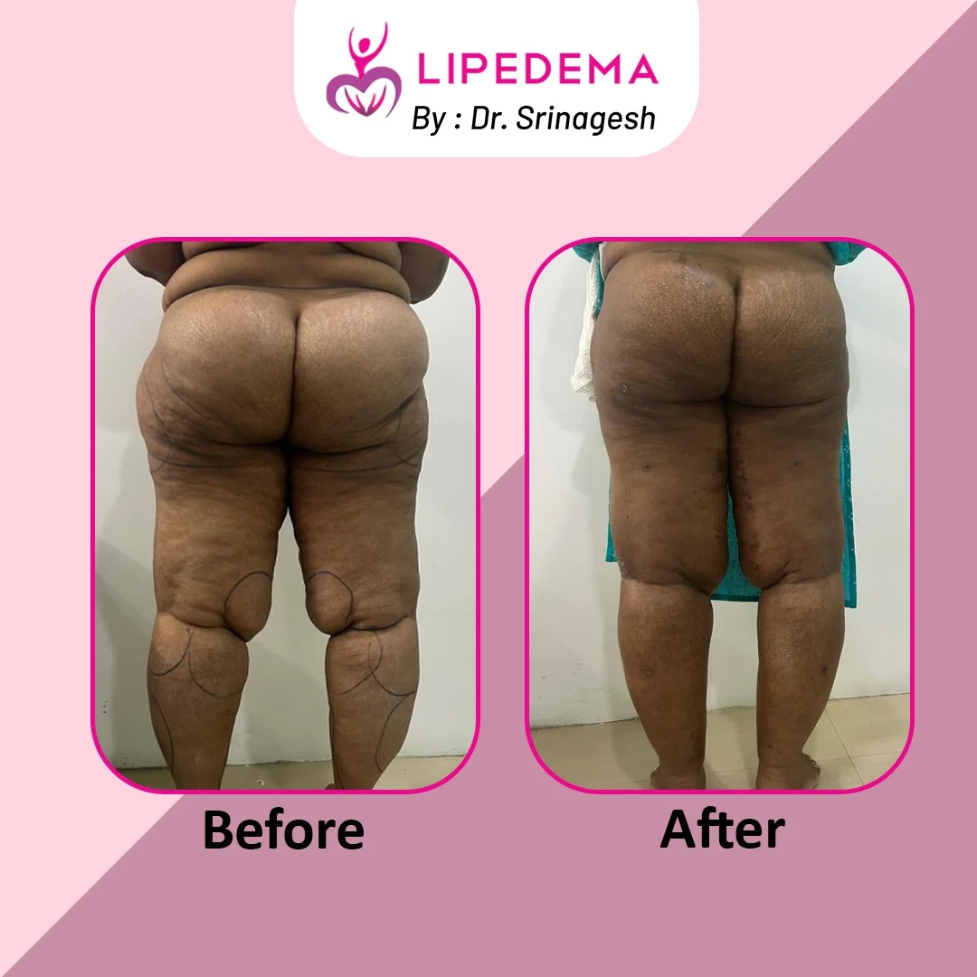 WhatsApp Image 2023-12-06 at 3.32.23 PM