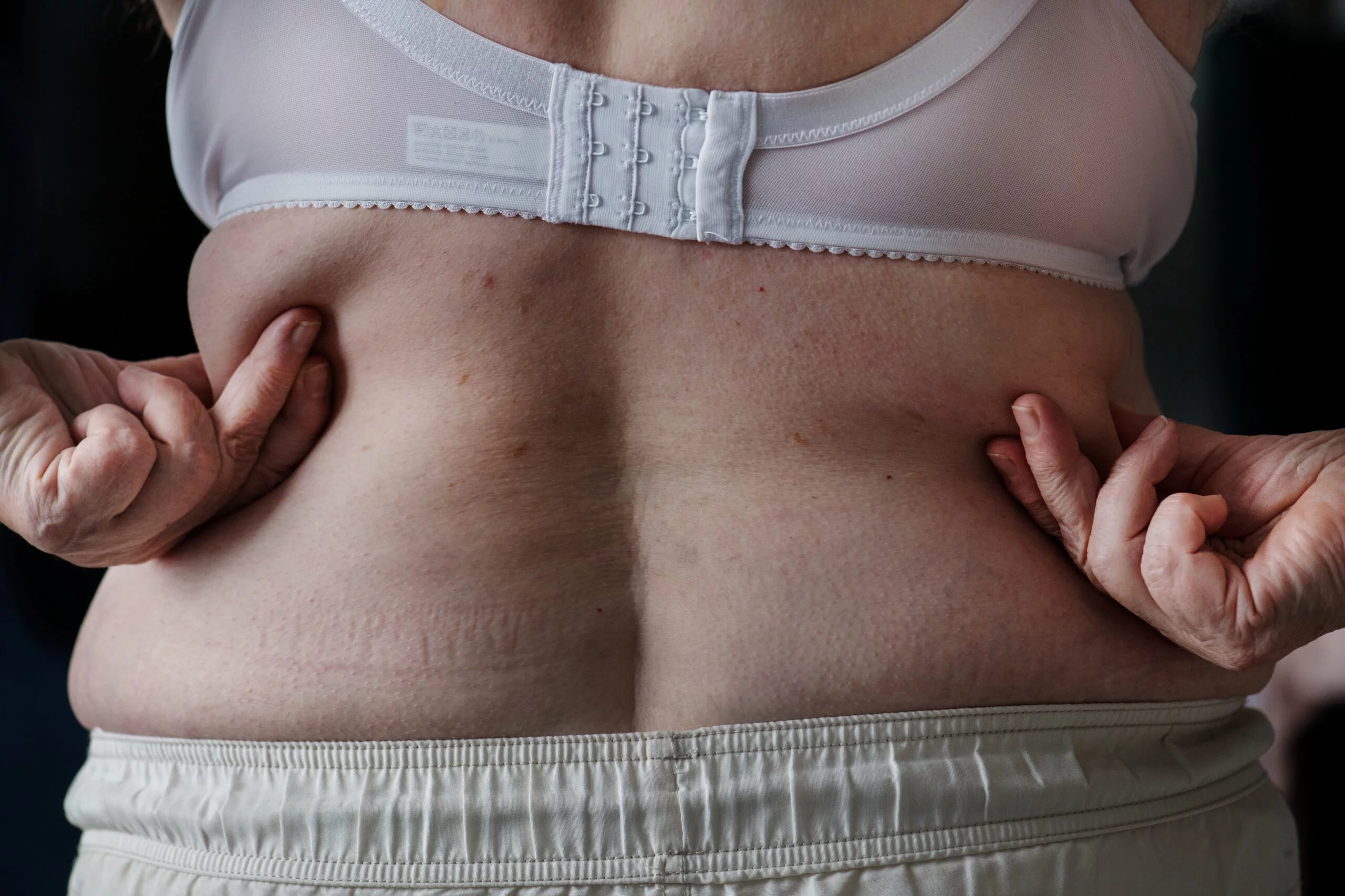 closeup-obese-elderly-woman (1)