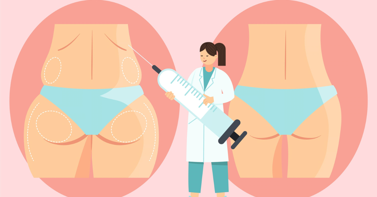 Thigh Fat Liposuction in Hyderabad